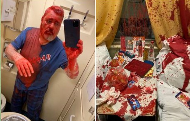 Rosja: Atak na noblistę Dmitrija Muratowa - został oblany czerwoną farbą z acetonem